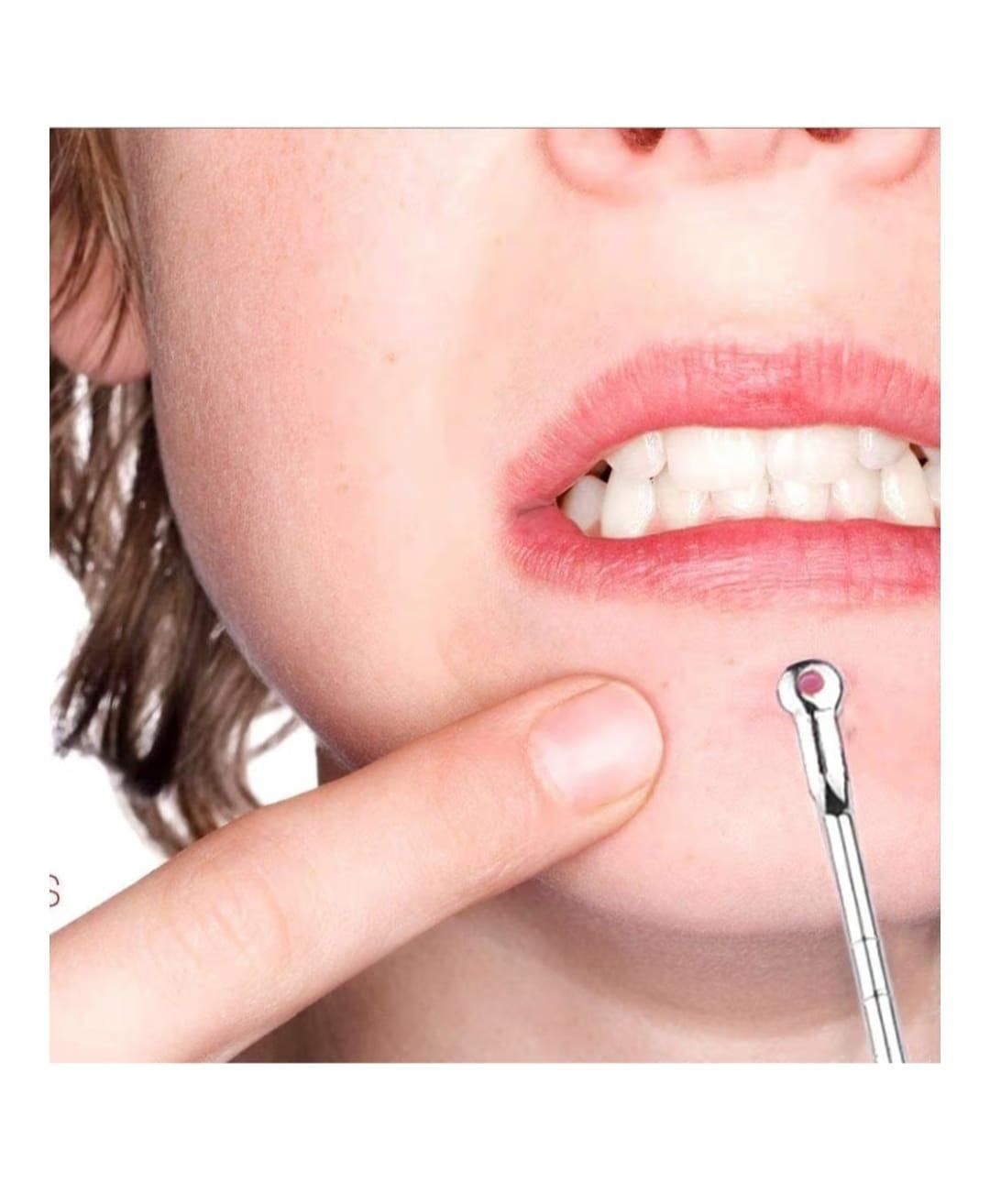 4pcs Set of Tools Spot Extractor Pore Cleansing Needle Hook Kit